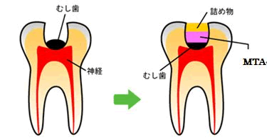 イラスト